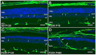 Retinal Vascular Degeneration in the Transgenic P23H Rat Model of Retinitis Pigmentosa